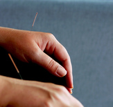Acupuncture needls on hands